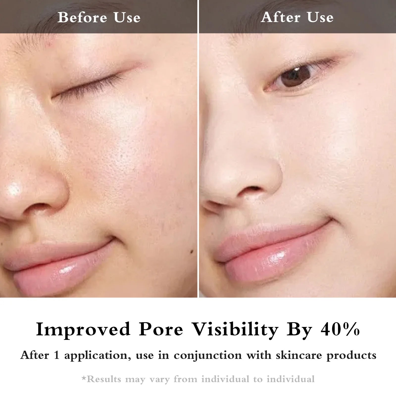 Facial EMS + IPL Skin Rejuvenation Beauty Device