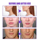 Double Chin Remover – Face Slimming Tool