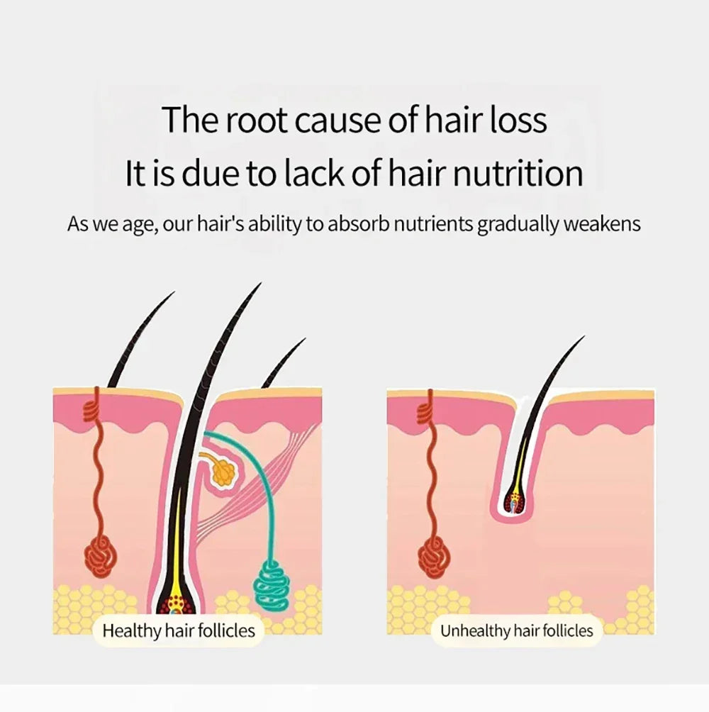 Vibration Scalp Massage Comb — Hair Growth Therapy - image 9