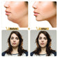 Reusable Face Lift Mask – V-Shape Slimming Patch