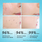 RtopR Exfoliating Facial Gel – Pore Cleanser & Scrub