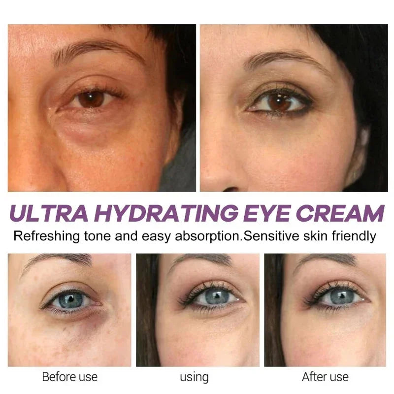 Instant Eye Bag Removal Cream – Retinol Firming Care