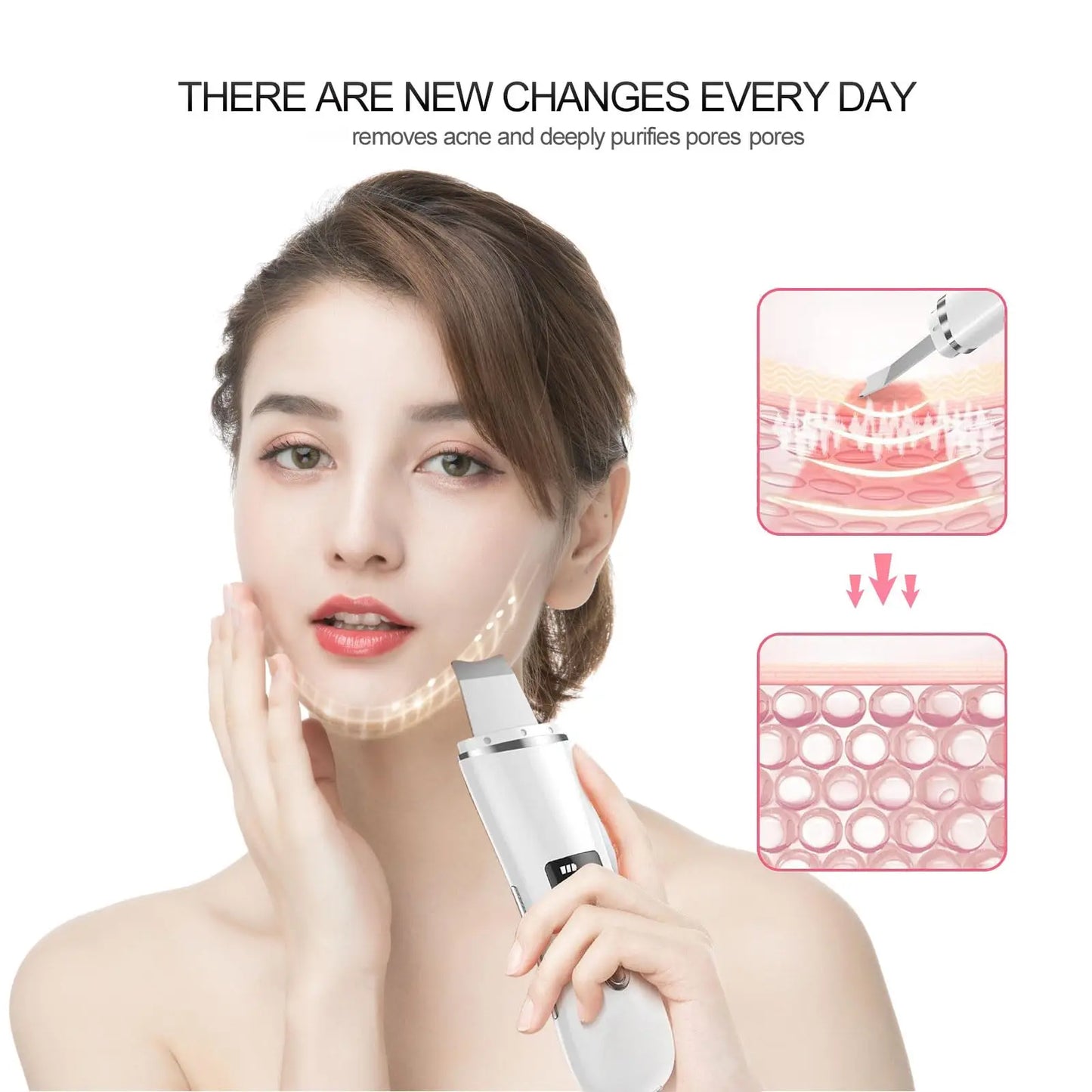 Ultrasonic Facial Cleaner – Acne & Blackhead Removal Device