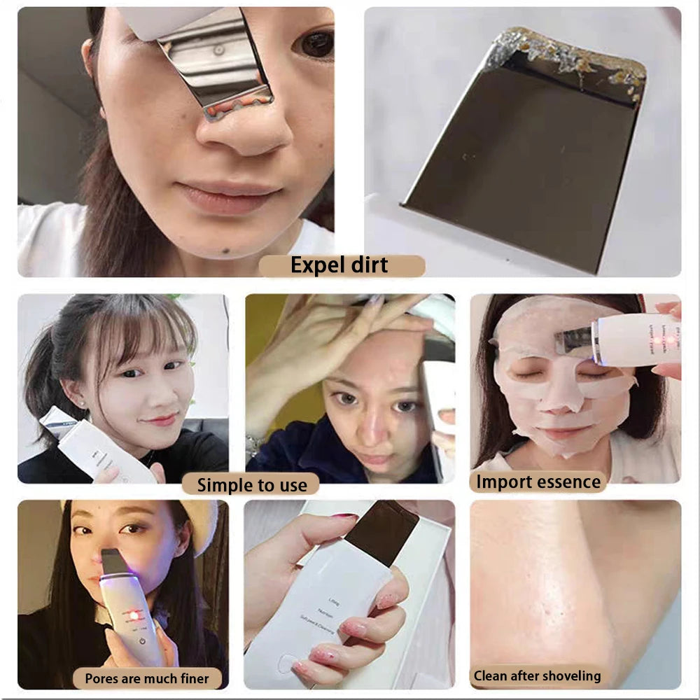 Electric Skin Scrubber – Blackhead & Acne Remover