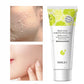 Fruit Acid Peeling Gel – Exfoliating & Blackhead Removal