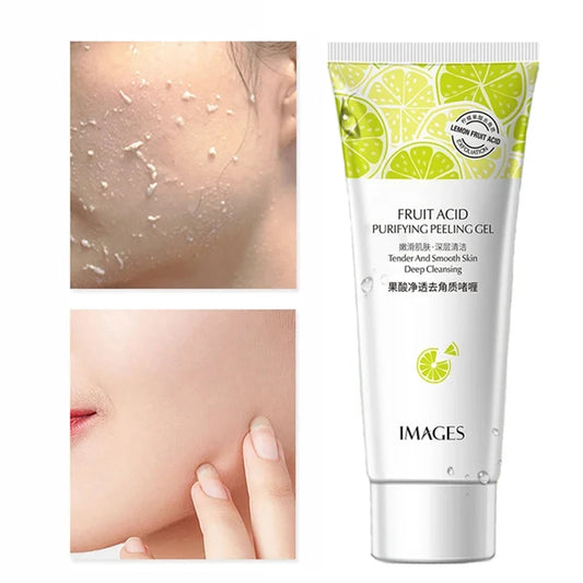 Fruit Acid Peeling Gel – Exfoliating & Blackhead Removal