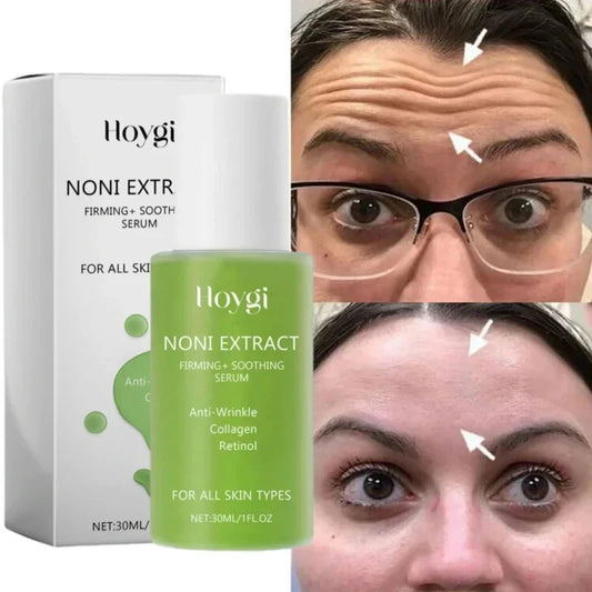 Noni Fruit Face Serum – Anti-Wrinkle & Moisturizing Essence