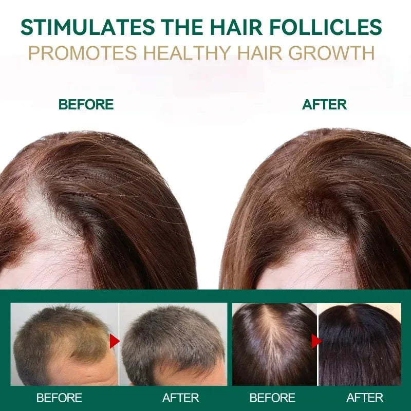 Ginger Hair Cream Hair Mask for Hair Growth Ginger Oil Prevent Loss Treatment Anti-Dandruff Smoothing Repair Care Cream
