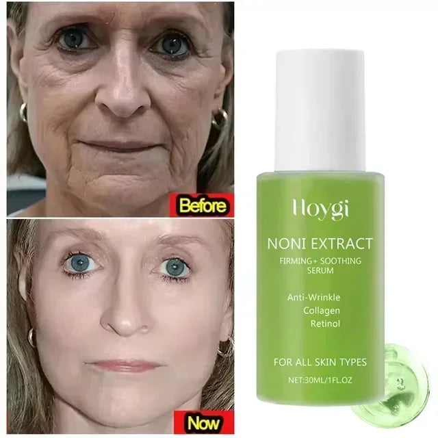 Noni Fruit Face Serum – Anti-Wrinkle & Moisturizing Essence