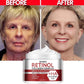 Retinol Face Cream – Korean Anti-Aging Skincare