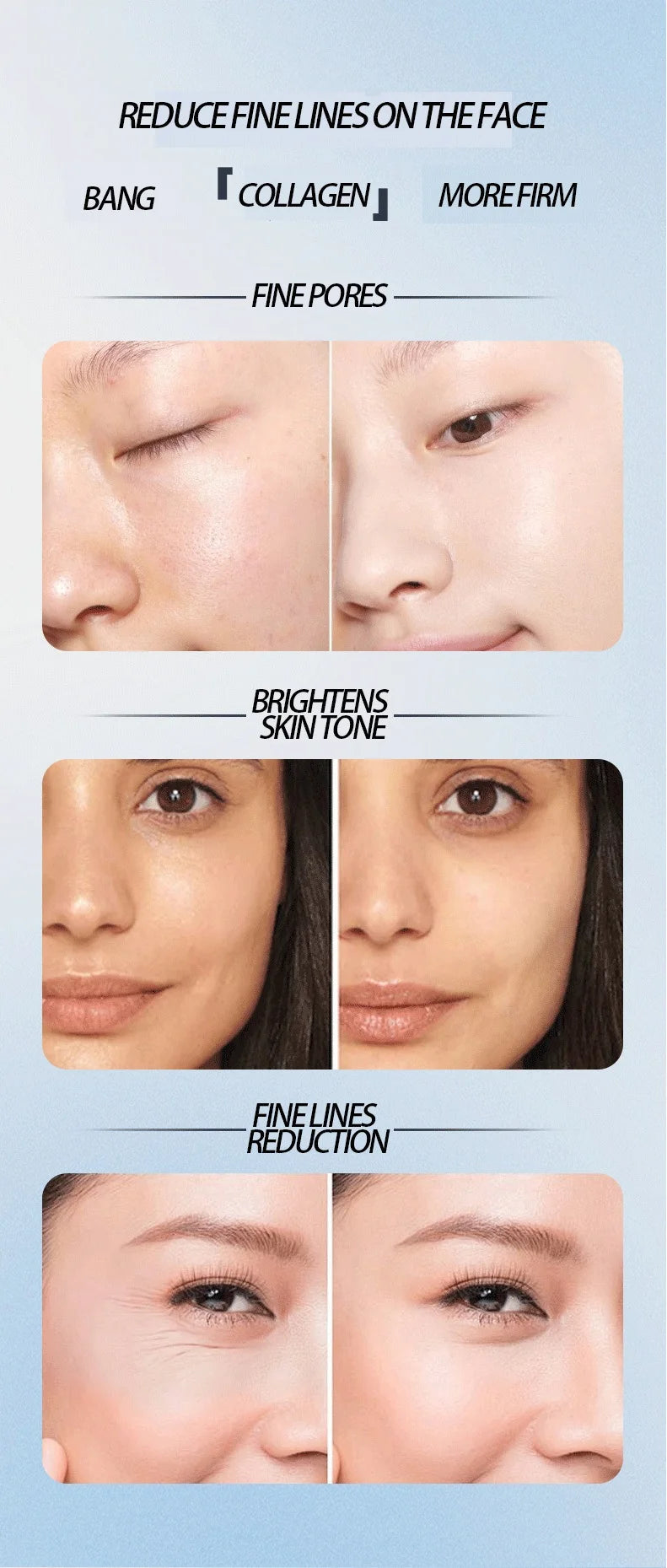 OmniLift EMS, RF & Cryo Multi-Function Facial Device