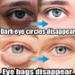 Instant Eye Bag Removal Cream – Retinol Firming Care