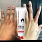 Kojic Acid Hand Cream – Brightening & Nourishing Skin Care