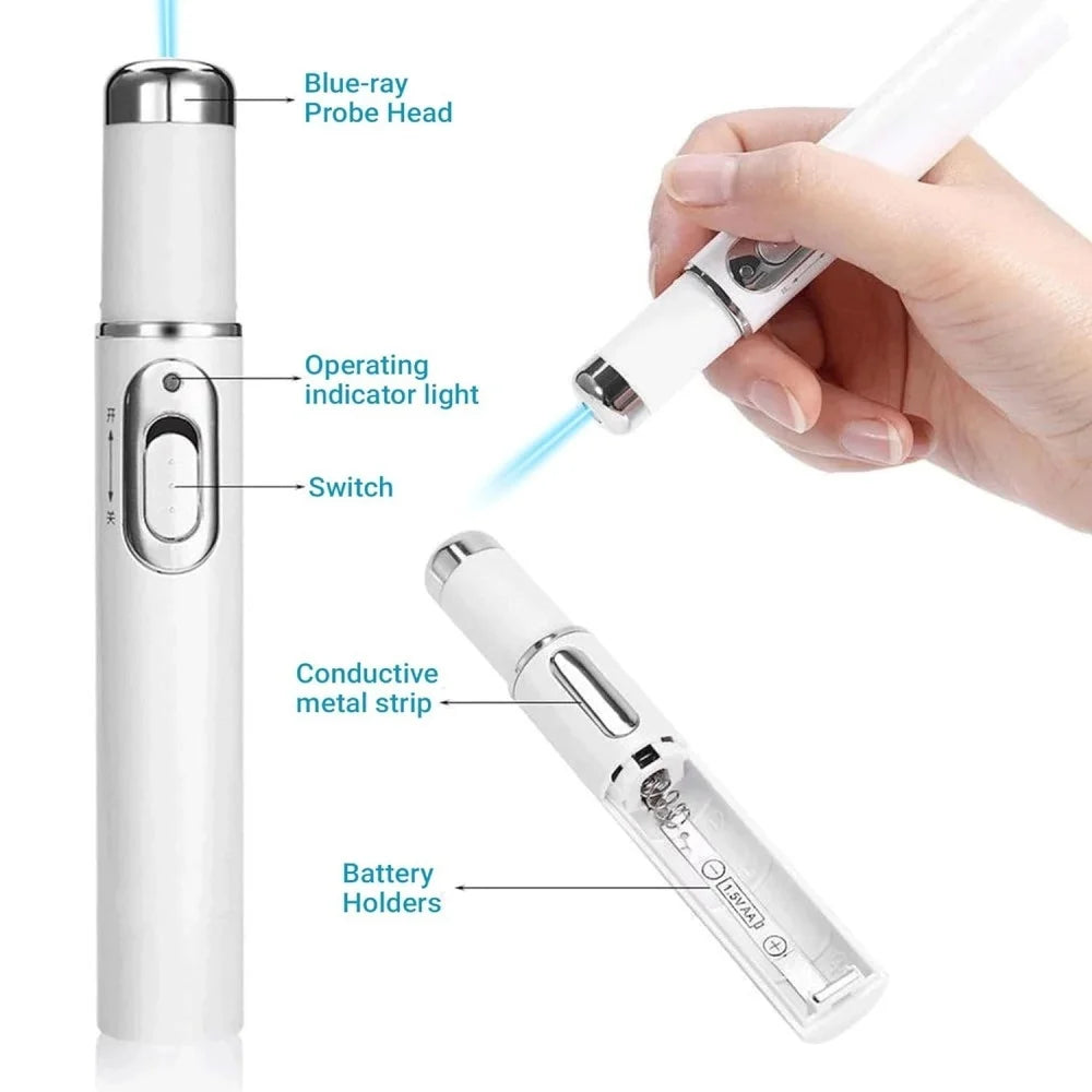 Blue Light Eye Massager Device For Dark Circles And Eyebag Relief