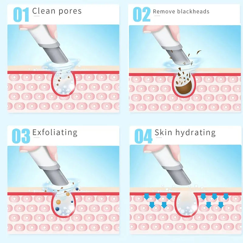 Small Bubble Oxygen Injection Aqua Facial Cleaning Device