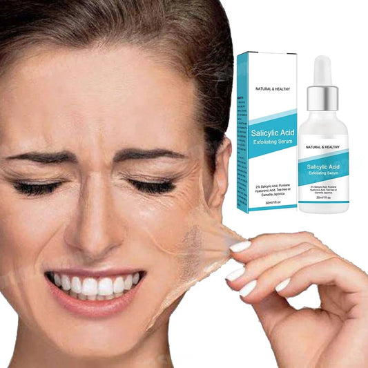 Facial Skin Peel Serum – Chemical Peel for Acne & Wrinkles