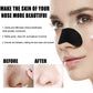 Blackhead Remover Nose Patches – Deep Cleansing (10/50/100pcs)