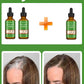Anti-Grey Hair Cream – Natural Black Color Restorer