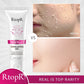 RtopR Exfoliating Facial Gel – Pore Cleanser & Scrub