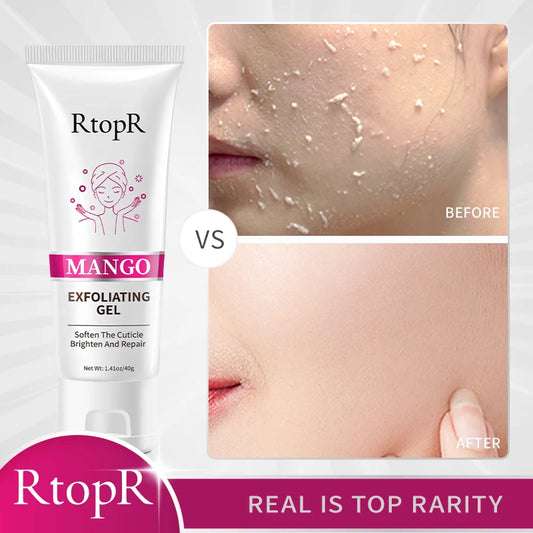 RtopR Exfoliating Facial Gel – Pore Cleanser & Scrub