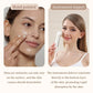 Facial Beauty Device EMS Microcurrent Introduction Facial Massager for Lifting and Firming Photon Skin Rejuvenation Anti-Wrinkle