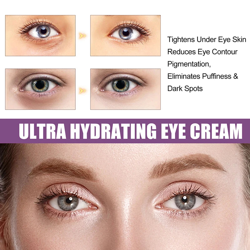 Instant Eye Bag Removal Cream – Retinol Firming Care