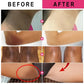 Body Whitening Cream – Intimate & Full Body Brightening
