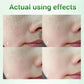 Salicylic Acid Pore Cream – Blackhead & Skin Repair Care