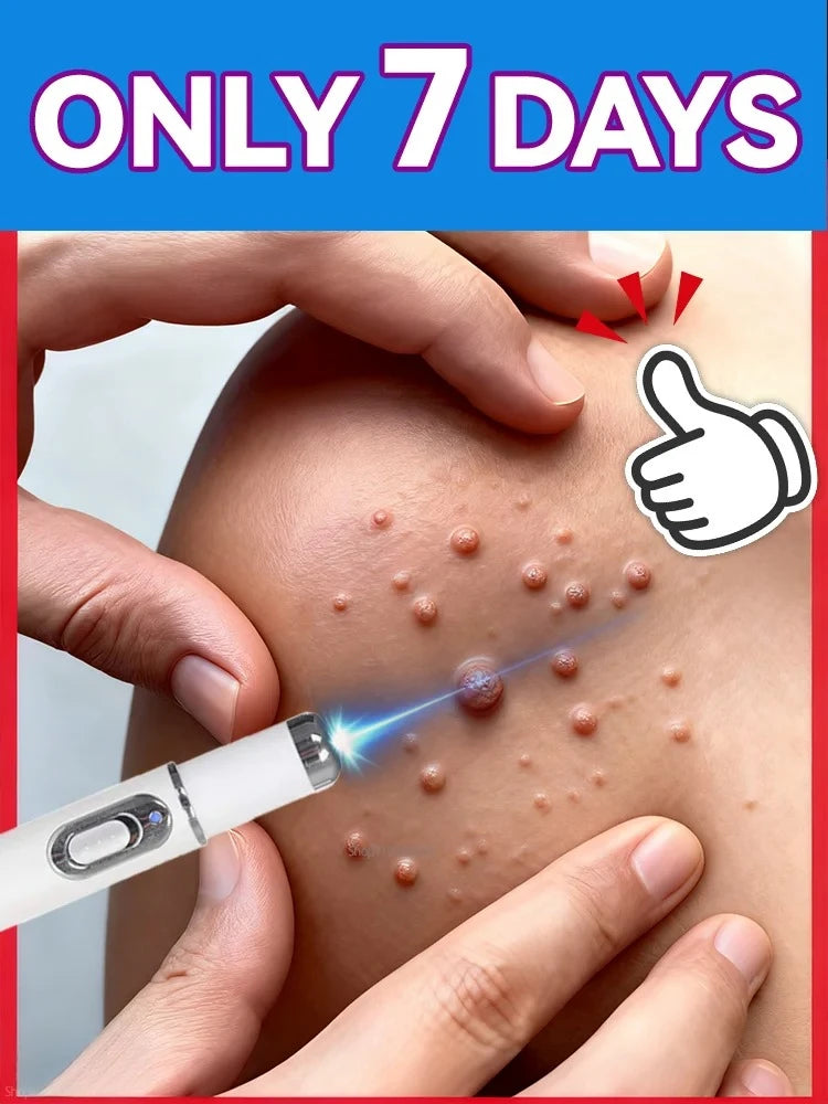 5ND Gᵉⁿᵉʳᵃᵗⁱᵒⁿ Uᵖᵍʳᵃᵈᵉᵈ wᵃʳᵗ ⸴ ʳᵉpᵃⁱʳ wᵃʳᵗˢ ʳᵒoᵗ ⸴ ᑫᵘⁱᶜᵏˡʸ OP