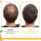 Biotin Hair Growth Shampoo – Anti-Hair Loss Treatment