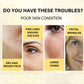 Collagen Protein Thread Serum Set – Wrinkle Remover & Firming