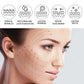 Facial Skin Peel Serum – Chemical Peel for Acne & Wrinkles