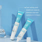 Acne Face Cream – Pimple Treatment & Oil Control Care