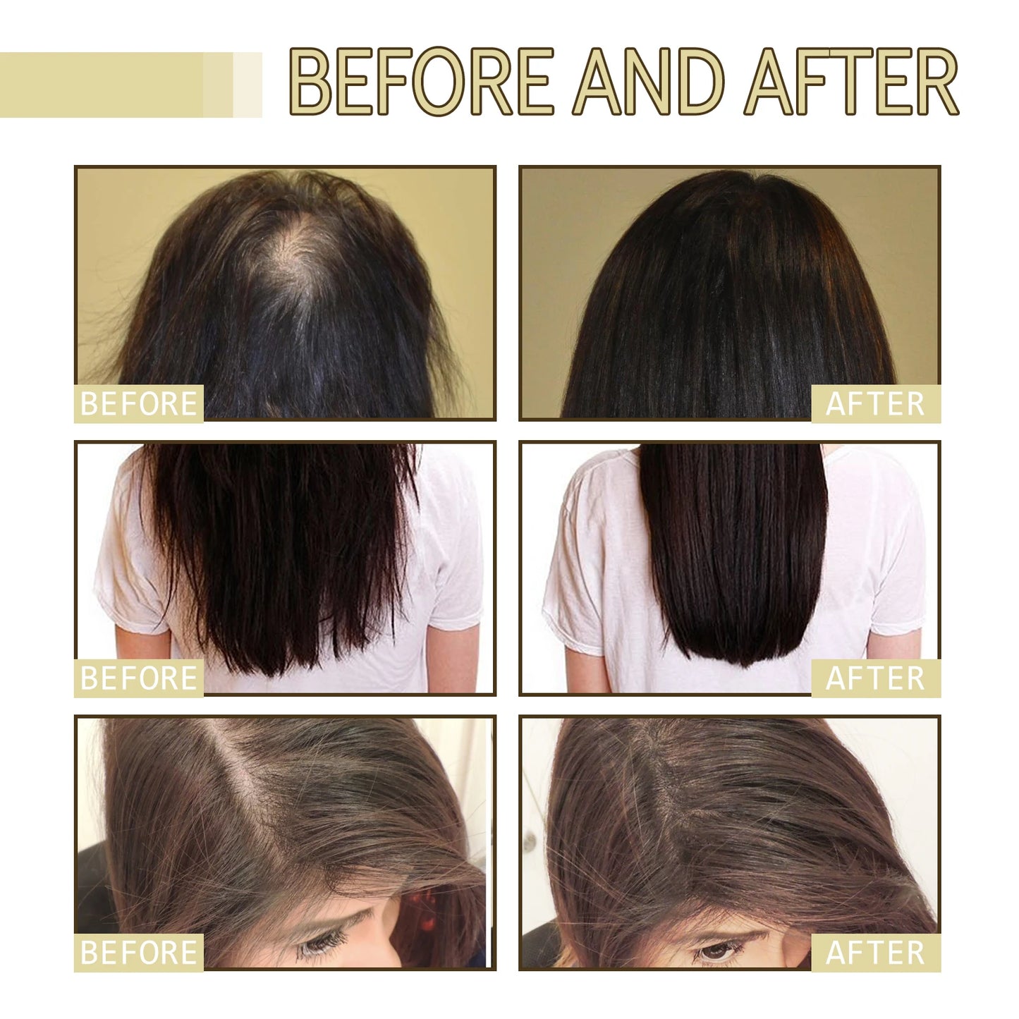 Rosemary Hair Oil – Repair & Shine Treatment