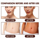 Self-Tanning Cream – Fast-Acting Face & Body Bronzer Lotion