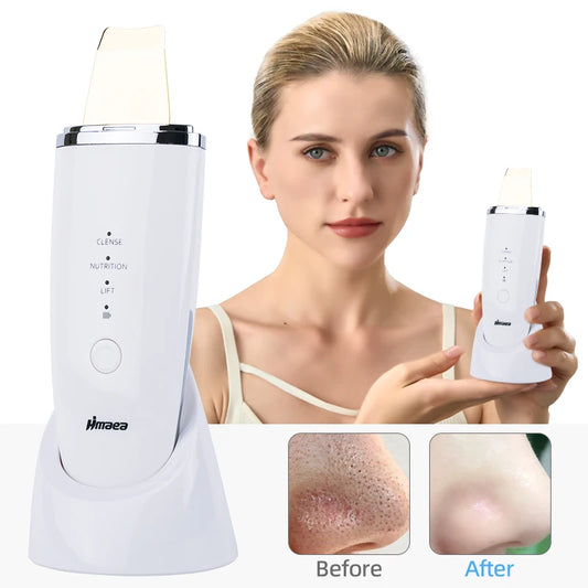 Ultrasonic Face Spatula – Blackhead & Pore Cleaner