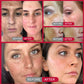 Whitening Freckle Cream – Dark Spot & Melasma Remover