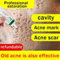 Men's Anti-acne Mark Pothole Repair Cream-Regeneration gel