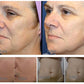 2-in-1 Plasma Skin Care Device – Hot & Cold Lifting Machine