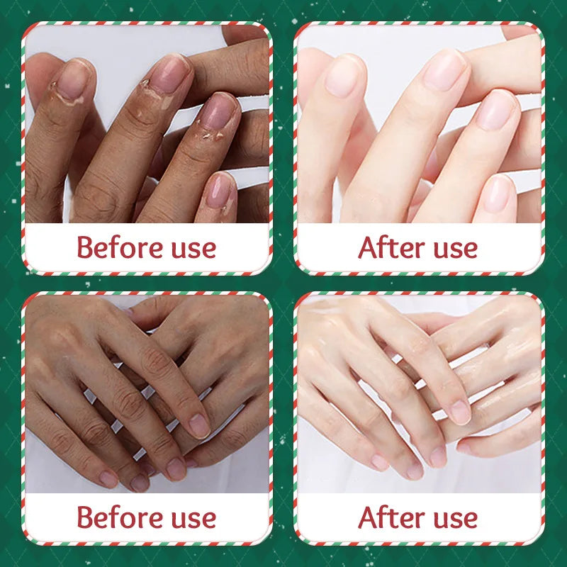 Sadoer Coconut Oil Hand Cream – Repair Dry & Cracked Skin 60g