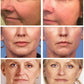 Retinol Wrinkle Remover Face Serum – Anti-Aging & Lifting
