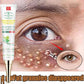 Fat Granules Remover Eye Cream – Anti-Wrinkle & Firming
