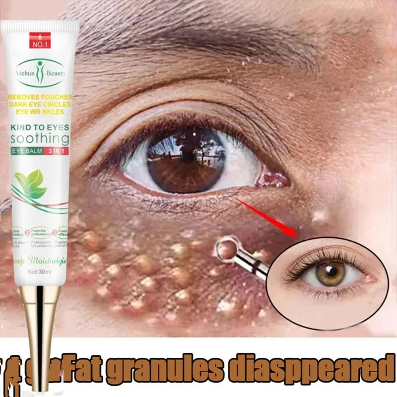 Fat Granules Remover Eye Cream – Anti-Wrinkle & Firming