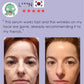 Retinol Wrinkle Remover Face Serum – Anti-Aging & Lifting