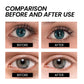 Eye Bag Removal Cream – Anti-Puffiness & Firming