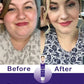 Double Chin Remover – Face Slimming Tool