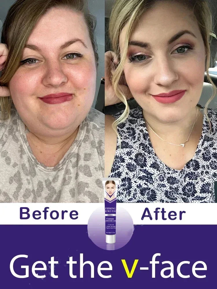 Double Chin Remover – Face Slimming Tool