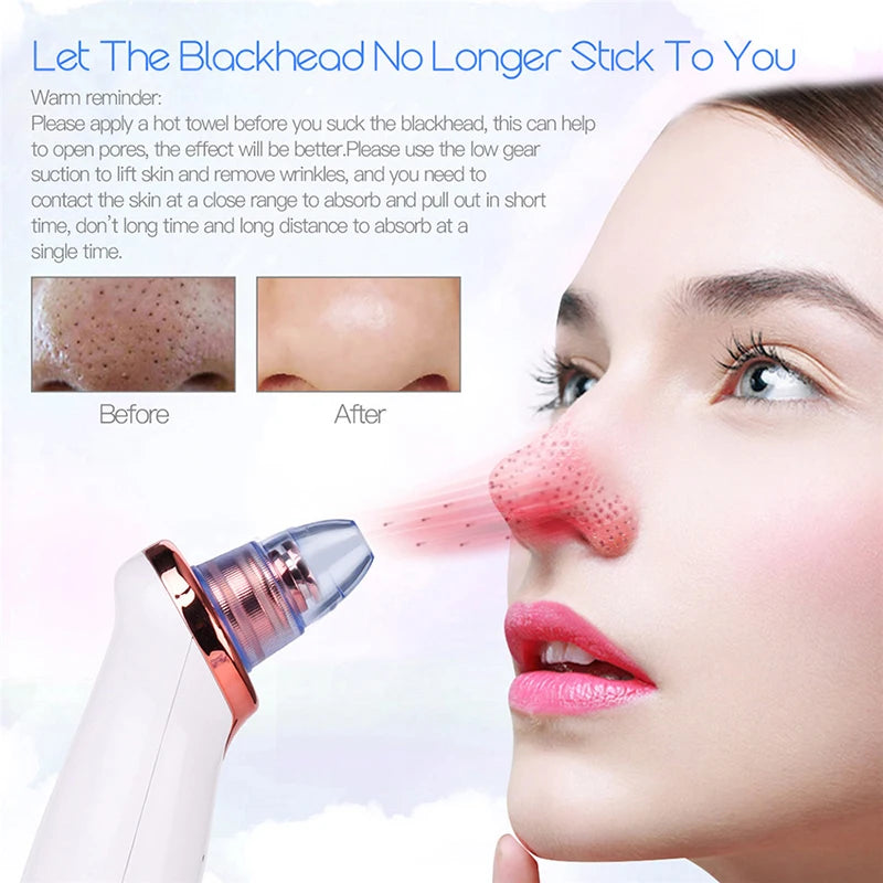USB Rechargeable Nose Vacuum Blackhead Remover Pore Extractor Tool