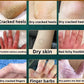 Collagen Hand Cream – Soften & Repair Dry Skin
