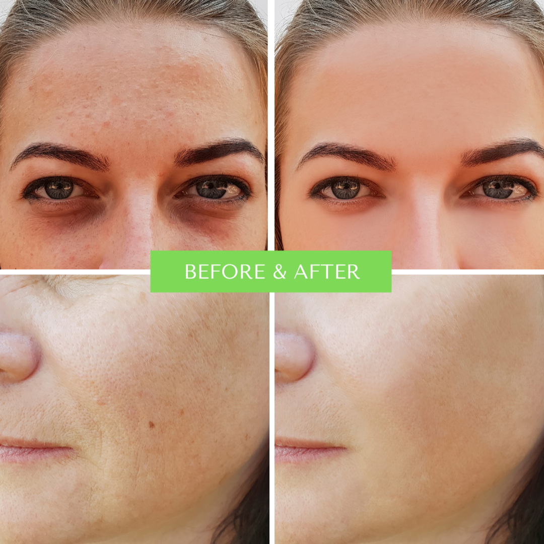 ORGANIC HYALURONIC WRINKLE DEFIER -  For Women and Men-3